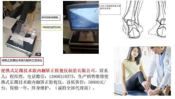 便攜式足踝技術跟內(nèi)翻矯正檢視儀