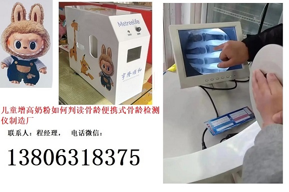 愛心匯聚校園溫暖助力成長兒童成長奶粉如何判讀骨齡便攜式骨齡檢